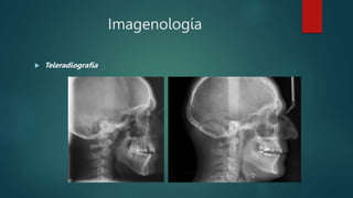 Imagenología
 Teleradiografía
 