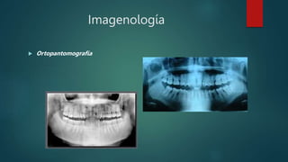 Imagenología
 Ortopantomografía
 