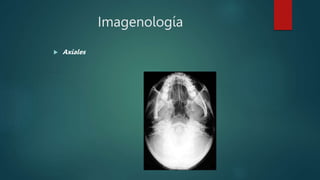 Imagenología
 Axiales
 