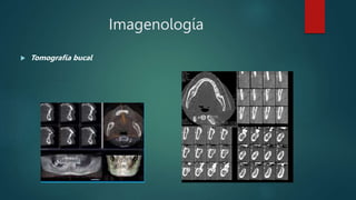 Imagenología
 Tomografía bucal
 