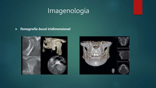 Imagenología
 Tomografía bucal tridimensional
 