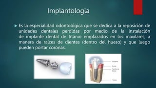 Implantología
 Es la especialidad odontológica que se dedica a la reposición de
unidades dentales perdidas por medio de la instalación
de implante dental de titanio emplazados en los maxilares, a
manera de raíces de dientes (dentro del hueso) y que luego
pueden portar coronas.
 