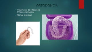  Tratamiento de ortodoncia
Ortodoncia invisible
 Técnica Invasilign
 