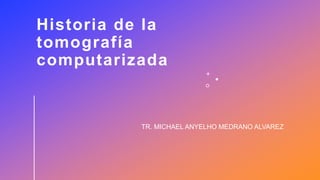 Historia de la
tomografía
computarizada
TR. MICHAEL ANYELHO MEDRANO ALVAREZ
 
