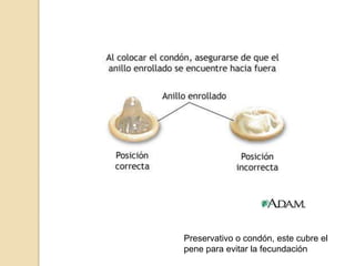 Preservativo o condón, este cubre el pene para evitar la fecundación