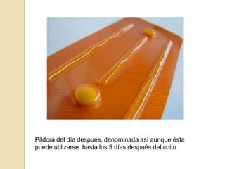 Píldora del día después, denominada así aunque ésta puede utilizarse  hasta los 5 días después del coito