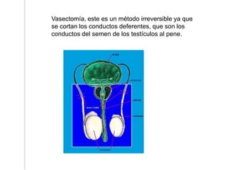 Vasectomía, este es un método irreversible ya que se cortan los conductos deferentes, que son los conductos del semen de los testículos al pene.