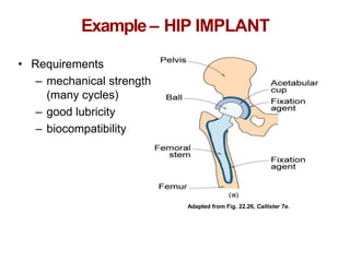 Chapter 1 -
Example– HIP IMPLANT
• Requirements
– mechanical strength
(many cycles)
– good lubricity
– biocompatibility
Adapted from Fig. 22.26, Callister 7e.
 
