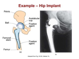 Chapter 1 -
Example – Hip Implant
Adapted from Fig. 22.26, Callister 7e.
 