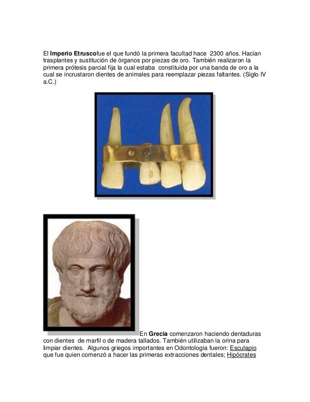 Historia de los materiales dentales