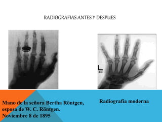 Historia de los rayos x | PPTX