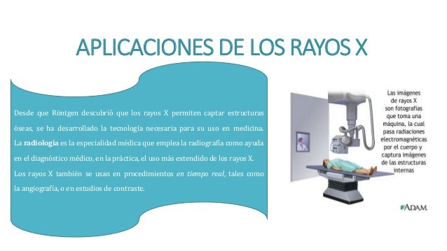 Uso De Los Rayos X | historia de los rayos x Uso De Los Rayos X | historia de los rayos x