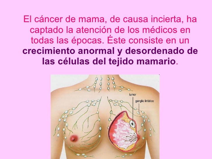 El pecho pequeño apretado