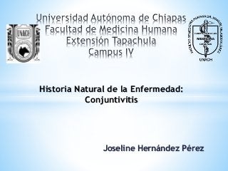 Joseline Hernández Pérez
Historia Natural de la Enfermedad:
Conjuntivitis
 
