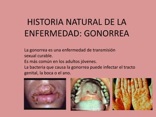 HISTORIA NATURAL DE LA
ENFERMEDAD: GONORREA
La gonorrea es una enfermedad de transmisión
sexual curable.
Es más común en los adultos jóvenes.
La bacteria que causa la gonorrea puede infectar el tracto
genital, la boca o el ano.
 