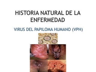 HISTORIA NATURAL DE LA
ENFERMEDAD
VIRUS DEL PAPILOMA HUMANO (VPH)
 