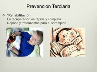 Prevención Terciaria
 *Rehabilitación:
La recuperación es rápida y completa.
Reposo y tratamientos para el sarampión.
 