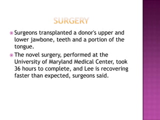  Surgeons  transplanted a donor's upper and
  lower jawbone, teeth and a portion of the
  tongue.
 The novel surgery, performed at the
  University of Maryland Medical Center, took
  36 hours to complete, and Lee is recovering
  faster than expected, surgeons said.
 