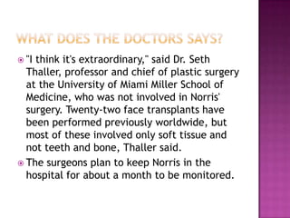  "Ithink it's extraordinary," said Dr. Seth
  Thaller, professor and chief of plastic surgery
  at the University of Miami Miller School of
  Medicine, who was not involved in Norris'
  surgery. Twenty-two face transplants have
  been performed previously worldwide, but
  most of these involved only soft tissue and
  not teeth and bone, Thaller said.
 The surgeons plan to keep Norris in the
  hospital for about a month to be monitored.
 