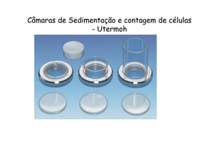 Câmaras de Sedimentação e contagem de células
- Utermoh
 