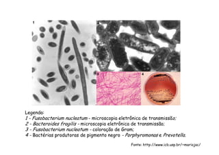 Legenda:
1 - Fusobacterium nucleatum - microscopia eletrônica de transmissão;
2 - Bacteroides fragilis - microscopia eletrônica de transmissão;
3 - Fusobacterium nucleatum - coloração de Gram;
4 - Bactérias produtoras de pigmento negro - Porphyromonas e Prevotella.
Fonte: http://www.icb.usp.br/~mariojac/
 
