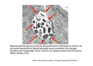 Esporos maduros (setas pretas) de Encephalitozoon intestinalis no interior de
um vacúolo parasitóforo (delimitado pelas setas vermelhas). Microscopia
eletrônica de transmissão. Fonte: Centers for Disease Control and Prevention
(CDC), Atlanta, EUA.
Fonte: http://www.icb.usp.br/~livropar/img/capitulo7/13.html
 