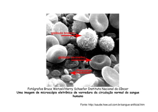 Fotógrafos Bruce Wetzel/Harry Schaefer Instituto Nacional do Câncer
Uma imagem de microscópio eletrônico de varredura da circulação normal do sangue
humano
Fonte: http://saude.hsw.uol.com.br/sangue-artificial.htm
 