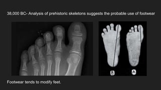 38,000 BC- Analysis of prehistoric skeletons suggests the probable use of footwear
Footwear tends to modify feet.
 