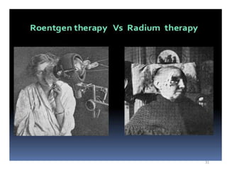 History of radiation therapy and application | PPTX