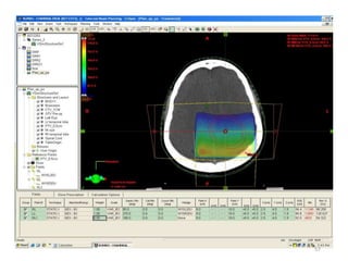 History of radiation therapy and application | PPTX