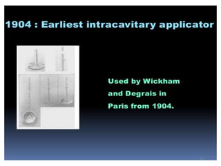 History of radiation therapy and application | PPTX