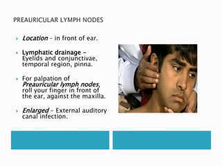 Location – in front of ear. 
 Lymphatic drainage - 
Eyelids and conjunctivae, 
temporal region, pinna. 
 For palpation of 
Preauricular lymph nodes, 
roll your finger in front of 
the ear, against the maxilla. 
 Enlarged - External auditory 
canal infection. 
 