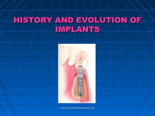 HISTORY AND EVOLUTION OF
IMPLANTS

www.indiandentalacademy.com

 