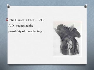oJohn Hunter in 1728 – 1793
A.D suggested the
possibility of transplanting.
 