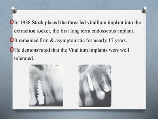 oIn 1938 Stock placed the threaded vitallium implant into the
extraction socket, the first long term endosseous implant.
oIt remained firm & asymptomatic for nearly 17 years.
oHe demonstrated that the Vitallium implants were well
tolerated.
 