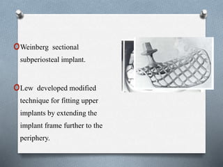 oWeinberg sectional
subperiosteal implant.
oLew developed modified
technique for fitting upper
implants by extending the
implant frame further to the
periphery.
 