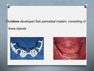 oLinkow developed Sub periosteal implant consisting of
three islands
 