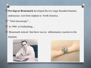oPer-Ingvar Branemark developed the two stage threaded titanium
endosseous root form implant in North America.
o“ Vital microscopy”…
o In 1960 at Gothenburg…
o Branemark noticed that there was no inflammatory reaction to the
titanium.
 