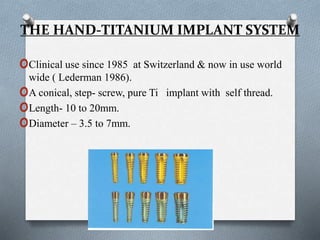 THE HAND-TITANIUM IMPLANT SYSTEM
oClinical use since 1985 at Switzerland & now in use world
wide ( Lederman 1986).
oA conical, step- screw, pure Ti implant with self thread.
oLength- 10 to 20mm.
oDiameter – 3.5 to 7mm.
 