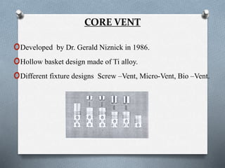 CORE VENT
oDeveloped by Dr. Gerald Niznick in 1986.
oHollow basket design made of Ti alloy.
oDifferent fixture designs Screw –Vent, Micro-Vent, Bio –Vent.
 