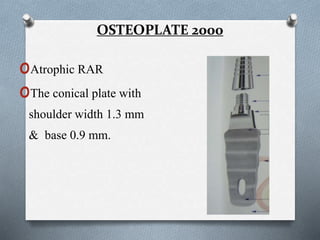 OSTEOPLATE 2000
oAtrophic RAR
oThe conical plate with
shoulder width 1.3 mm
& base 0.9 mm.
 