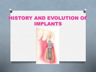 HISTORY AND EVOLUTION OF
IMPLANTS
 