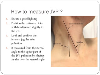 Hx and CE of the cardiovascular system.pptx