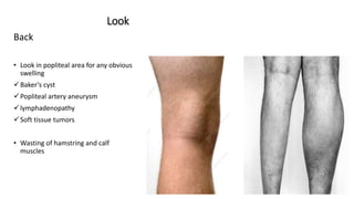 History and examintion of knee joint slideshare | PPTX