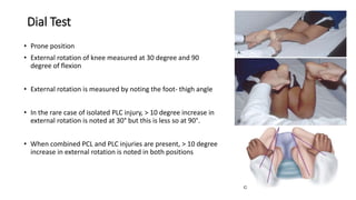 Dial Test History and examintion of knee joint slideshare | PPTX