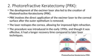 Comprehensive Refraction Comprehensive History and Advances in Refractive Eye Surgery Techniques ...