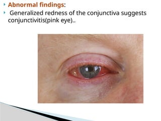 History and Physical assessment of patients with eye disorders and ...
