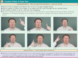 History and Physical assessment of patients with eye disorders and ...