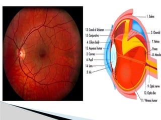 History and Physical assessment of patients with eye disorders and ...