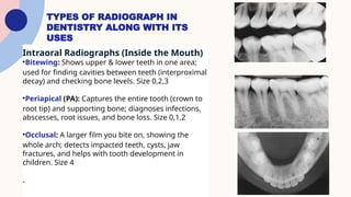 History and principle of x-ray Concept of X-ray | PPTX